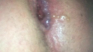 Huge Anal Insertions and Gaping