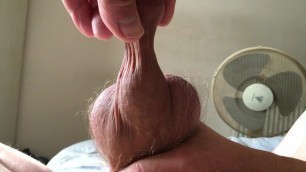Foreskin with ball - 2 of 4